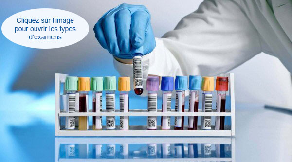 img-examenLabo laboOran-MediLab boukhatmi